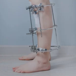 External fixators
